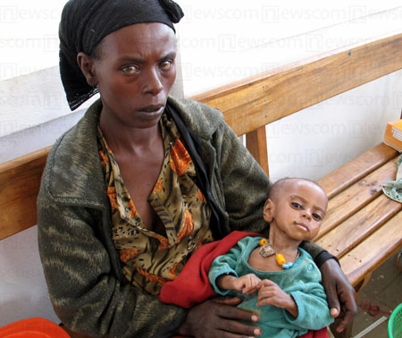 Nine-month-old Alfiya Galeto weighed just 10 lbs. when she arrived at a clinic in Shashemene, Ethiopia, Africa. There was no food in their village, her mother said. Sites such as this in are not uncommon in Africa, which has been affected by world hunger for many years. (Shashank Bengali/MCT)