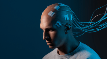 man with electrodes attached to his head